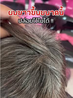 ปล่อยไว้ไม่ได้น้าอายคนแย่เลย ✨ #แชมพูปิดผมขาว #ไบโอนิวเทรียนท์ #ไบโอวูเมนส์ #ปิดผมขาว #ปิดผมหงอกสนิท 